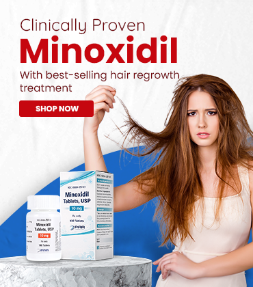 Minoxidil_banner_MV_1